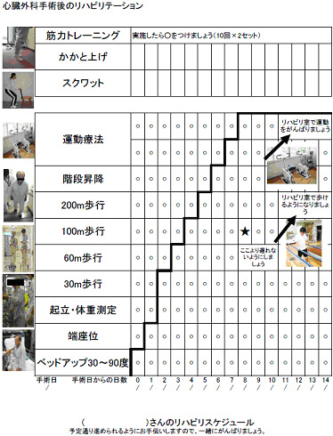 心臓外科手術後のリハビリテーション