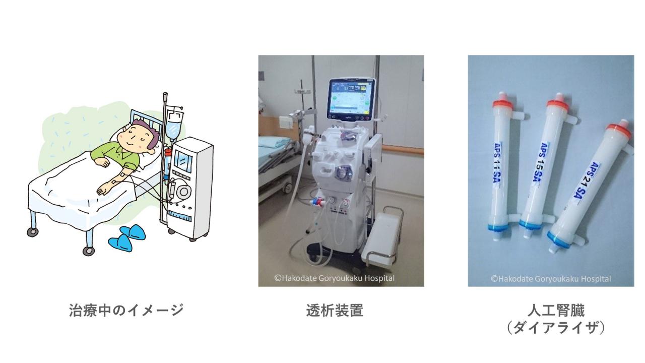 在宅で行なう血液透析｜函館五稜郭病院